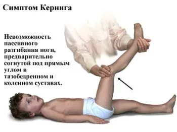 Вірусний менінгіт симптоми - 21 рецепт! (Ввечері перед сном) Вірусний менінгіт симптоми - 21 рецепт!