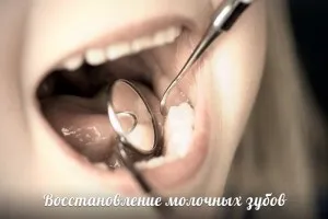 Відновлення молочних зубів (зубів) Відновлення молочних зубів