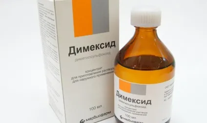 Як можна відмити лінолеум після ремонту (відмити) Як можна відмити лінолеум після ремонту