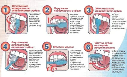 Як лікують зубний камінь в стоматології і який лікар його видаляє, красиві (видалення зубного каменю) Як лікують зубний камінь в стоматології і який лікар його видаляє, красиві