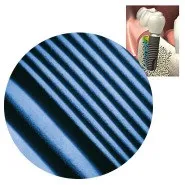 Astra tech- імплантати, імплантація зубів астра тек (Conical Seal Design) Astra tech- імплантати, імплантація зубів астра тек