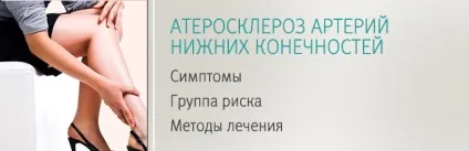 Атеросклероз артерій нижніх кінцівок (атеросклероз артерій нижніх) Атеросклероз артерій нижніх кінцівок