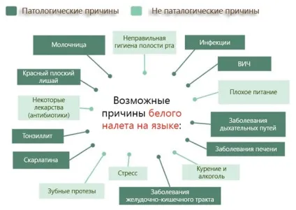 Білий мову - причини білого нальоту на мові (білого) Білий мову - причини білого нальоту на мові
