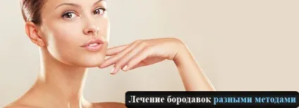 Бородавки, лікування бородавок сучасними методами (сучасними) Бородавки, лікування бородавок сучасними методами