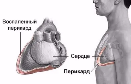 Біль в серці при вдиху - причини, методи реагування на проблему