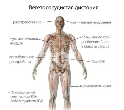 Чим відрізняється гіпертонія від ВСД за гіпертонічним типом підвищений тиск