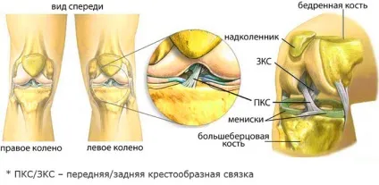 Що робити, якщо хрустять коліна
