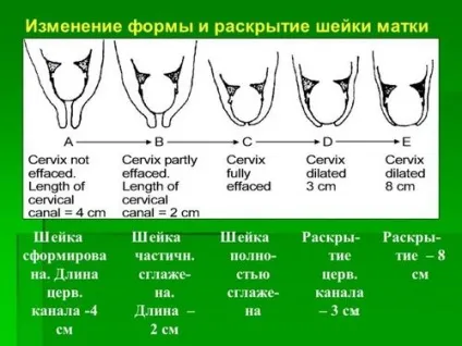 Що означає коротка шийка матки при вагітності (означає) Що означає коротка шийка матки при вагітності