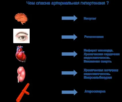 Що потрібно знати про ниркової гіпертонії (знати) Що потрібно знати про ниркової гіпертонії