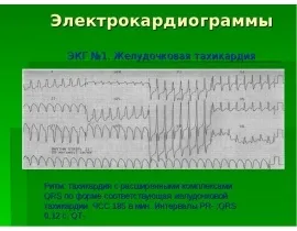 Що за знаки перед нами скачати презентацію (скачати презентацію) Що за знаки перед нами скачати презентацію