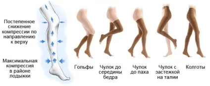 Що таке компресійна терапія