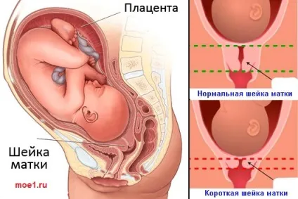 Що таке шийка матки і яку функцію вона виконує (таке) Що таке шийка матки і яку функцію вона виконує
