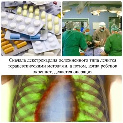 Що викликає декстрокардіі, діагностика, лікування та профілактика (2627089626 data-ad-format rectangle) Що викликає декстрокардіі, діагностика, лікування та профілактика
