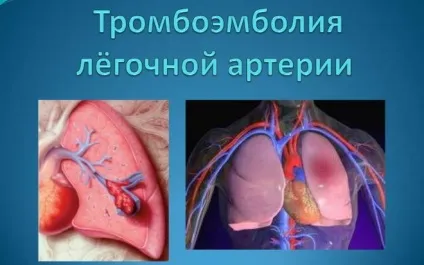 Тисне за грудиною посередині важко дихати причини стану, способи лікування і профілактики