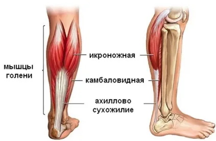 деформація Хаглунд