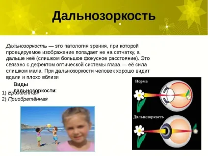 Далекозорість у дітей - причини, симптоми і лікування у дитини