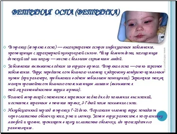Дитячі інфекції - презентація медицина (інфекції) Дитячі інфекції - презентація медицина