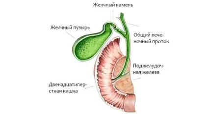 Дієта при холециститі жовчного міхура хронічної, гострої форми і каменях (дієта при холециститі) Дієта при холециститі жовчного міхура хронічної, гострої форми і каменях