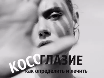 Як визначити і вилікувати косоокість (ознаки косоокості) Як визначити і вилікувати косоокість