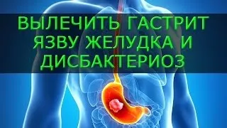 Ерозивний коліт кишечника лікування, симптоми і причини (кишечника) Ерозивний коліт кишечника лікування, симптоми і причини