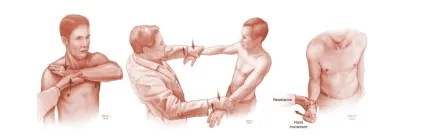Ендопротезування ліктьового суглоба (суглоба) Ендопротезування ліктьового суглоба