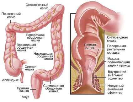 Ерозивний коліт кишечника причини, симптоми і лікування (кишечника) Ерозивний коліт кишечника причини, симптоми і лікування