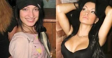 Феофилактова до операції і після - відповіді і поради (після) Феофилактова до операції і після - відповіді і поради