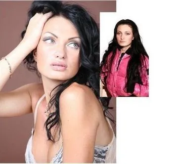Феофилактова до операції і після - відповіді і поради (Євгенія Феофилактова Антон) Феофилактова до операції і після - відповіді і поради