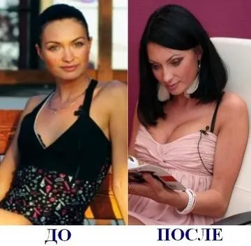 Феофилактова до операції і після - відповіді і поради (Євгенія Феофилактова Антон) Феофилактова до операції і після - відповіді і поради