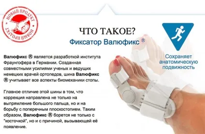 Фіксатор кісточки на великому пальці ноги відгуки, ефективність, переваги та недоліки (ноги) Фіксатор кісточки на великому пальці ноги відгуки, ефективність, переваги та недоліки