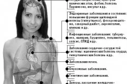 Гіпергідроз голови і обличчя причини і лікування патології (гіпергідроз) Гіпергідроз голови і обличчя причини і лікування патології