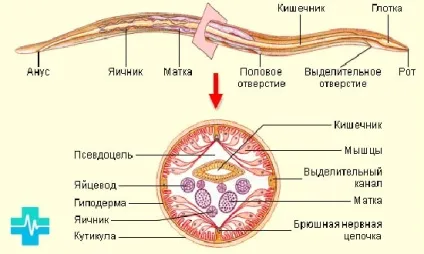 Глисти у організмі людини (можна поставити клізму) Глисти у організмі людини