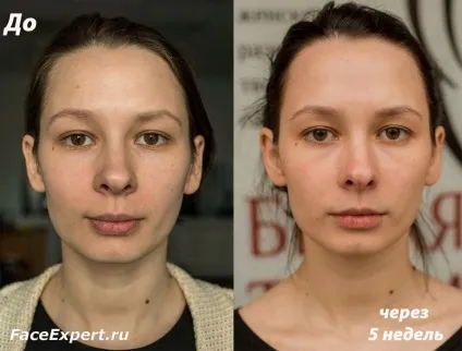 Гімнастика для обличчя та шиї