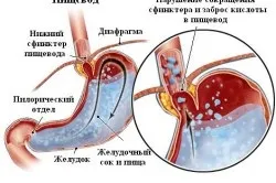 Грибок у дітей симптоми і лікування (грибок) Грибок у дітей симптоми і лікування