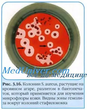 коки