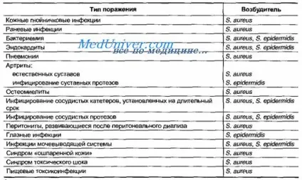 коки