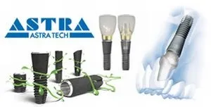 Імпланти astra tech (астра тек) види, технології, відгуки, переваги, ціна (імплант астра тек ціна) Імпланти astra tech (астра тек) види, технології, відгуки, переваги, ціна