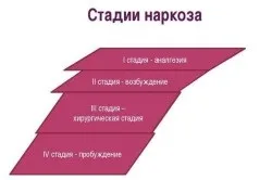 Як часто можна робити загальний наркоз (робити) Як часто можна робити загальний наркоз
