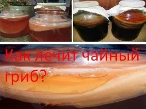 Як лікує чайний гриб, мій знахар (користь гриба) Як лікує чайний гриб, мій знахар