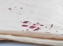 Як відіпрати кров з постільної білого білизни (кров постільної білизни) Як відіпрати кров з постільної білого білизни