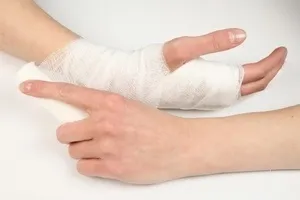 Як зняти набряк після перелому руки рецепти здоров'я (набряк) Як зняти набряк після перелому руки рецепти здоров'я