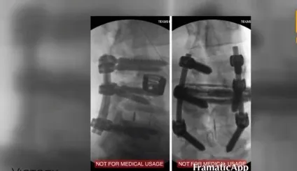 Як здувся зараз Ронни Колеман травми, інвалідність, операци, останні фото (здувся) Як здувся зараз Ронни Колеман травми, інвалідність, операци, останні фото