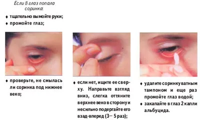 Як витягнути смітинку (вію, волосся) з ока (витягнути) Як витягнути смітинку (вію, волосся) з ока