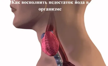 Як заповнити недолік йоду в організмі (недолік) Як заповнити недолік йоду в організмі