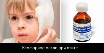 Камфорне масло застосування в вухо дітям, інструкція, компрес при кашлі, відгуки (масло) Камфорне масло застосування в вухо дітям, інструкція, компрес при кашлі, відгуки