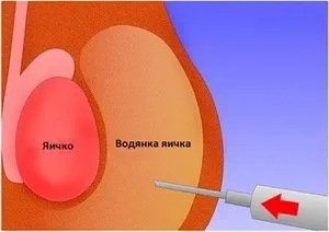 Коли (у скільки років) у хлопчиків опускаються яєчка - вік, патології та лікування, чому ні (патології) Коли (у скільки років) у хлопчиків опускаються яєчка - вік, патології та лікування, чому не