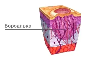 Коріння бородавок фото, як виглядає корінь бородавки (корінь) Коріння бородавок фото, як виглядає корінь бородавки
