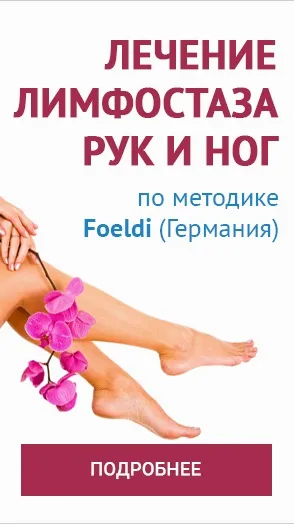 Лікування лімфостазу ноги - центр флебологии доктора Савінова (ноги) Лікування лімфостазу ноги - центр флебологии доктора Савінова