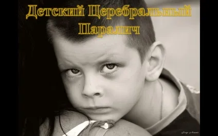 Лікування дитячої епілепсії (дитячої) Лікування дитячої епілепсії