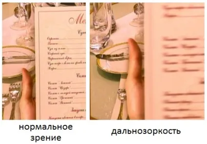 Лікування далекозорості в домашніх умовах краплі, вправи